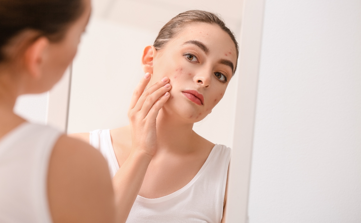 Impacto Del Mal Descanso En La Piel: Lo Que Tu Rostro Revela Cuando No Duermes Bien